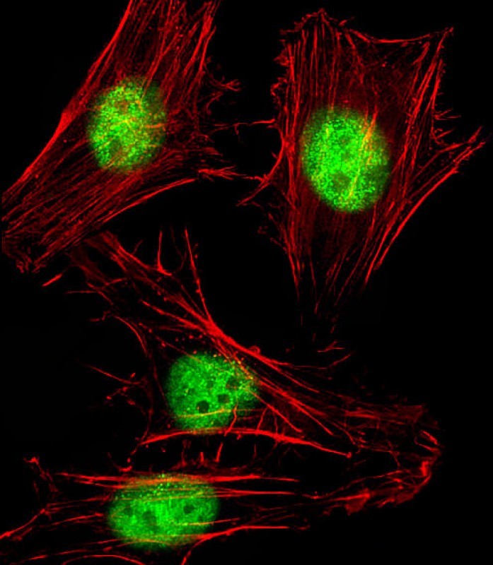 IF - SNW1 Antibody (C-Term) AP21848b